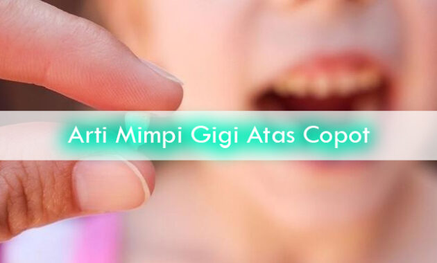 Arti-Mimpi-Gigi-Atas-Copot